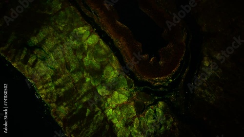 Stratified squamous epithelium. 100x times magnification. Forms the outermost layer of the skin and the inner lining of the mouth, esophagus and vagina. Darkfield microscopy photo