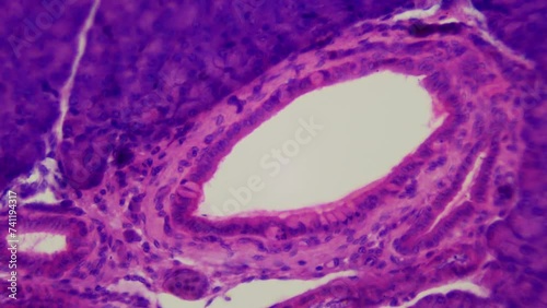 Pancreas. Microanatomy. Pancreatic biopsy section. 400x magnification. Digestive system of animals and humans, external secretory (exocrine) and intrasecretory (endocrine) functions photo