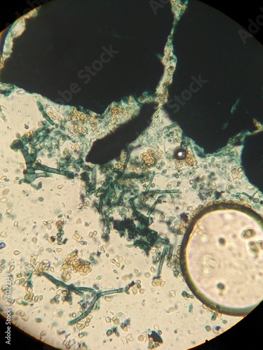 Fotografie Zoology histology microscopy collection arthropod mite tick tissue muscle connec