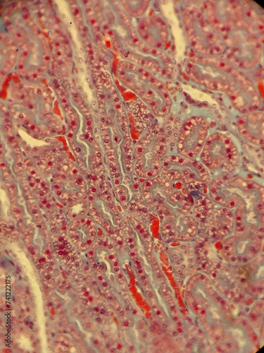 Fotografie Zoology histology microscopy collection arthropod mite tick tissue muscle connec