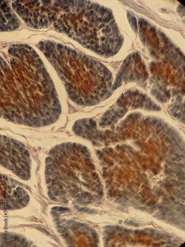 Tableau sur toile Zoology histology microscopy collection arthropod mite tick tissue muscle connec