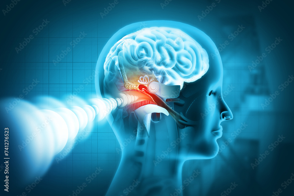 © Crystal light - The anatomical structure of the human ear, sound wave and ear with middle ear, otitis, auditory canal, ear pain, auditory canal and cochlea nerve, 3d illustration © Crystal light - The anatomical structure of the human ear, sound wave and ear with middle ear, otitis, auditory canal, ear pain, auditory canal and cochlea nerve, 3d illustration
