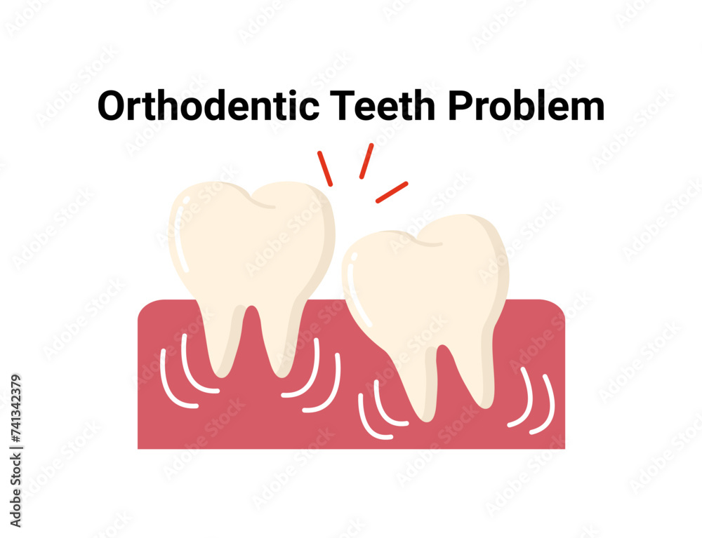 Orthodontic teeth flat illustration. Dentistry and orthodontics vector illustration. Dental clinic services, stomatology, dentistry, orthodontics, oral health care and hygiene vector. Orthodontic teeth flat illustration. Dentistry and orthodontics vector illustration. Dental clinic services, stomatology, dentistry, orthodontics, oral health care and hygiene vector.