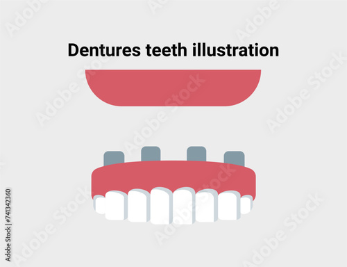 Dentures teeth flat illustration. Dentistry and orthodontics vector illustration. Dental clinic services, stomatology, dentistry, orthodontics, oral health care and hygiene vector.