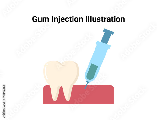 Gum injection flat illustration. Dentistry and orthodontics vector illustration. Dental clinic services, stomatology, dentistry, orthodontics, oral health care and hygiene vector.