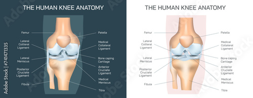 The human knee anatomy vector illustration. Common knee problems, Symptoms and causes of rheumatoid arthritis and osteoarthritis. Types of knee joint Injuries and Disorders. General condition and pain photo