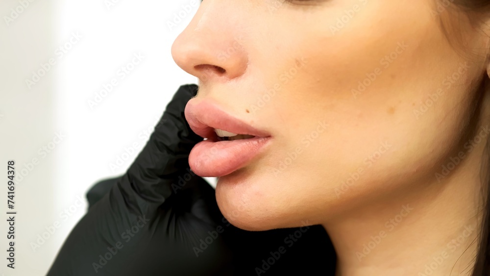 Close-up of a young woman's female lips after beauty injections. Cosmetology services, injection surgical cosmetology. Close-up of a young woman's female lips after beauty injections. Cosmetology services, injection surgical cosmetology.