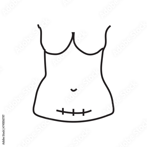 Transverse incision line icon. Abdominal incisions. Scars line icon in vector, c-section scar illustration