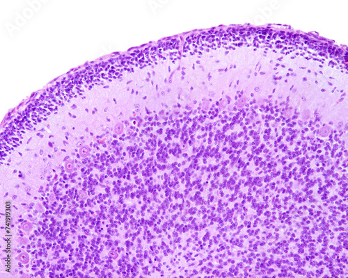 Immature cerebellum. External granular layer photo