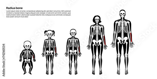 Radius bone anatomy