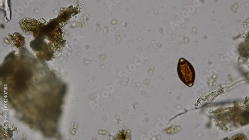 Finding Trichuris trichiura egg and Strongyloides egg in the feces under the microscope in Lab.