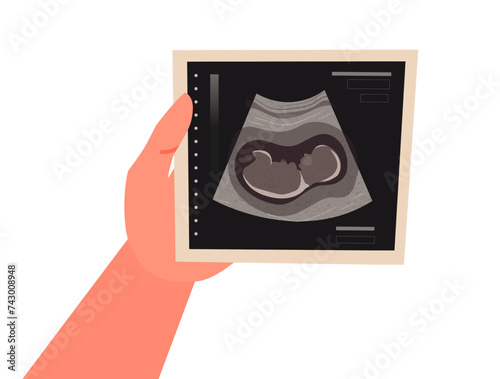 Ultrasound scan in hand. Baby ultrasound picture. Photo of ultrasound examination of infant. Cartoon vector illustration