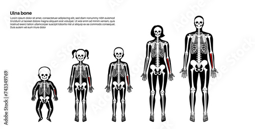 Ulna bone anatomy