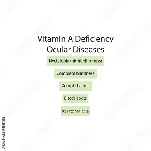 Diagram showing Vitamin A deficiency related ocular diseases - keratomalcia, xerophthalmia, night blindness, bitot's spots - simplified schematic diagram.