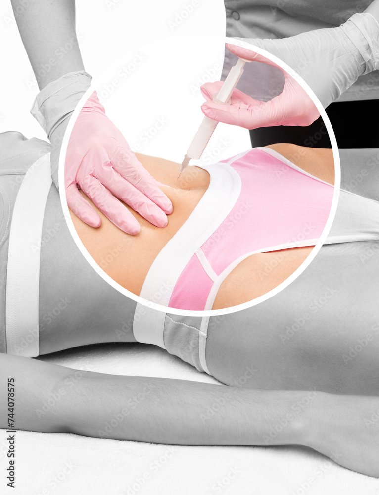 Φωτογραφία Aesthetic cosmetologist makes lipolytic injections to burn fat on the body of a woman