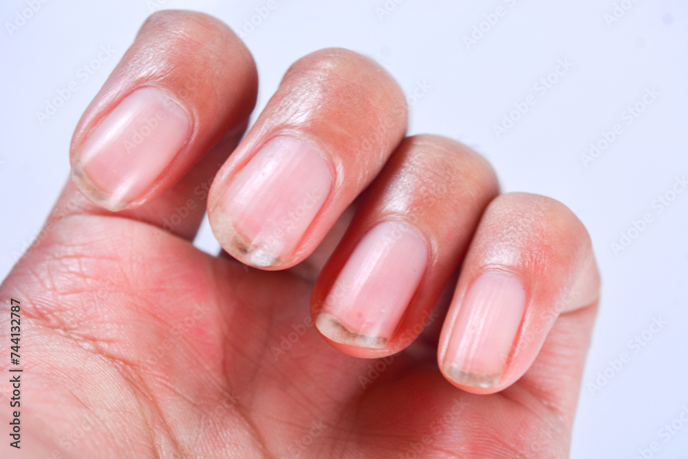 Close up of a woman’s dirty hands and fingernails after gardening