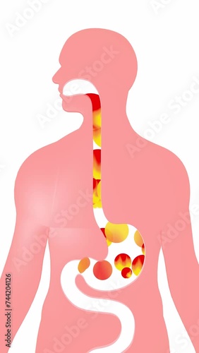 Vertical 3d animation of digestive system with moving fire circles. Esophagus with gastric reflux and heartburn on human silhouette.