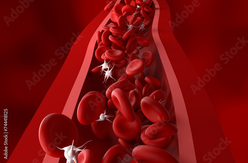 Reduced platelet (thrombocytes) count in Immune thrombocytopenic purpura (ITP) - front view 3d illustration photo