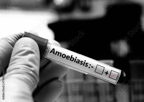 Blood sample of patient positive tested for amoebiasis. photo