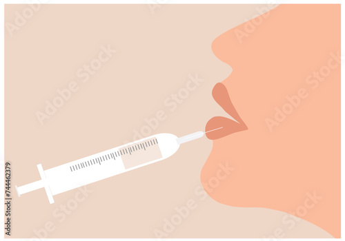 Filler injection concept. Serum syringe injects filler to lip of woman vector illustration. Plastic, aesthetic cosmetology beauty treatment concept