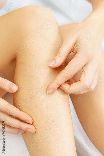 Unrecognizable young woman touches her hairy legs with her hands. Female sits at home on a white bed. Hair removal, depilation procedures for beauty. Naturalness and body care.