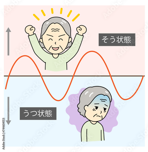 躁うつ病のそう状態とうつ状態を繰り返すおばあさんとグラフ