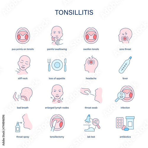 Tonsillitis symptoms, diagnostic and treatment vector icons. Medical icons.