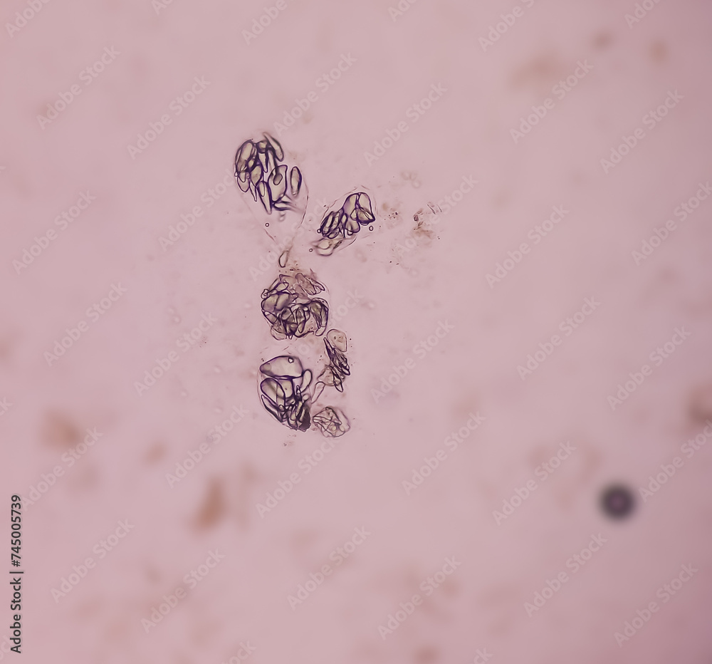 Giardia Lamblia Cysts And Trophozoite Form Muscle Fiber In Stool Examination Under 40x Light 0863