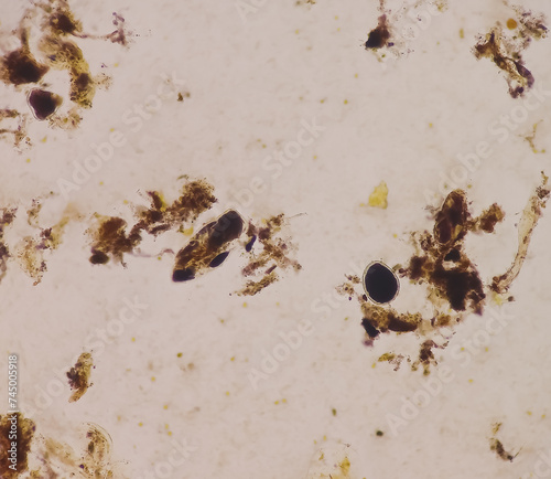Giardia lamblia cysts and Trophozoite form, muscle fiber in stool examination, under 40X light microscope, selective focus. © MdBabul