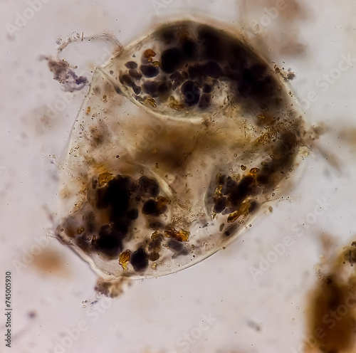 Parasitic Ova and Cysts and Trophozoite form, muscle fiber in stool examination, under 40X light microscope, selective focus. photo