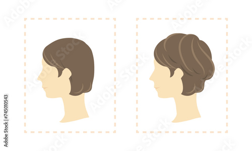 女性用部分ウィッグのビフォーアフターイラスト