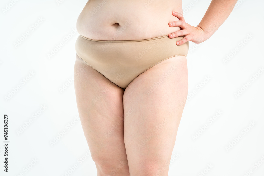Overweight thigh, woman with fat hips and legs, obesity female body with cellulite on gray background