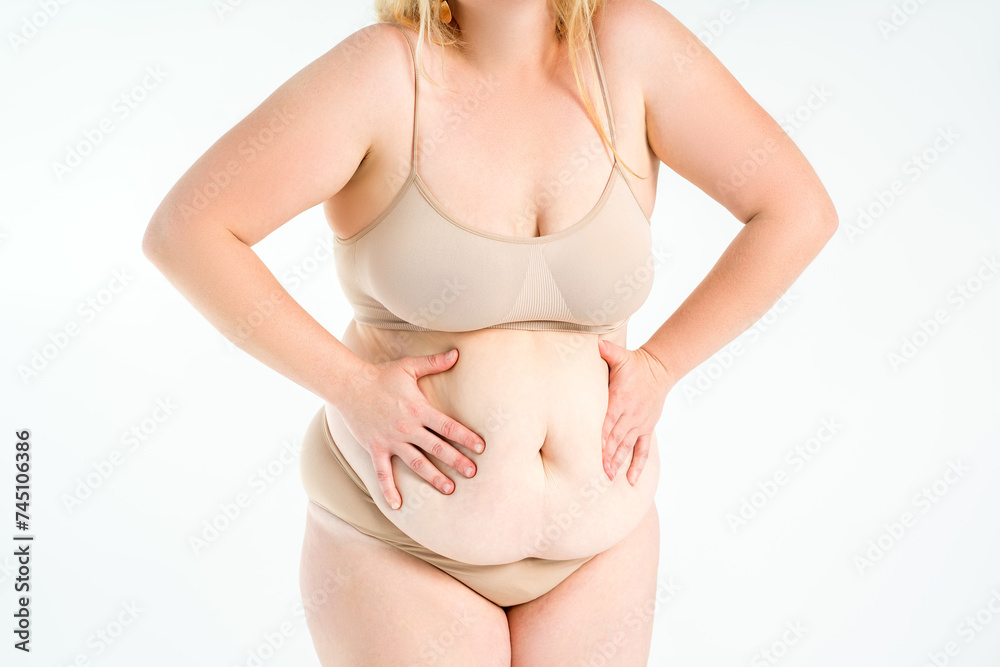 Tummy tuck, flabby skin with stretch marks on a fat belly, plastic surgery concept on gray background Tummy tuck, flabby skin with stretch marks on a fat belly, plastic surgery concept on gray background