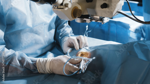 Open eye. Patient under sterile cover. Close-up. Laser vision correction. Patient and surgeon in operating room during ophthalmic surgery or diagnosis. photo