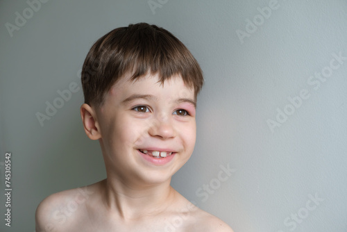 Portrait of happy beautiful joyful little 6 year boy with red swollen eye isolated on grey background. Kid looks side. Positive person. Good mood. Copy space. Alive emotions. Concept of happiness