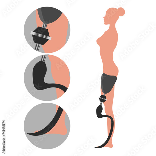 Legs Prosthetic Limb woman Prosthesis, artificial leg side, Disabled athlete