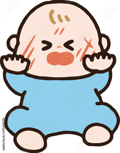 自分の爪で顔をひっかいて傷を作ってしまった赤ちゃん