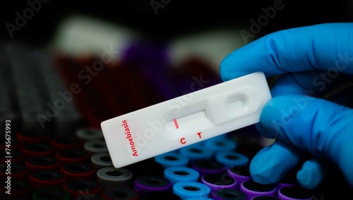 Blood sample of patient negative tested for amoebiasis by rapid diagnostic test. photo
