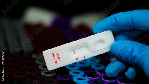 Blood sample of patient negative tested for varicella zoster by rapid diagnostic test.