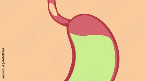 Stomach Acid Relux. Esophagus, gerd. Pain In The Digestive System, Gastritis, pyrosis, Acid Reflux Disease GERD, 2D animation photo