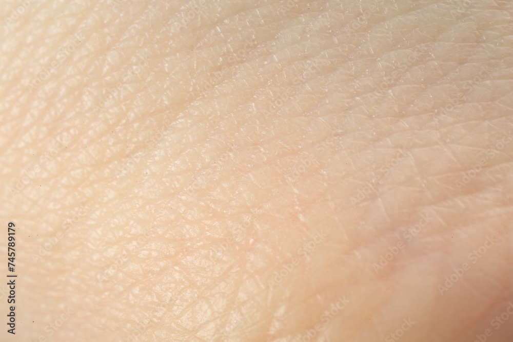 Fototapeta premium Texture of dry skin as background, macro view