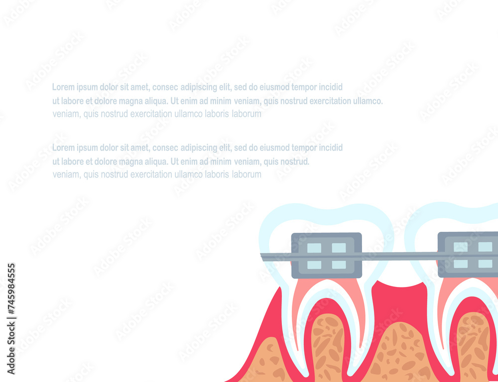 Dentistry Stomatology poster,White Background.Vector illustration