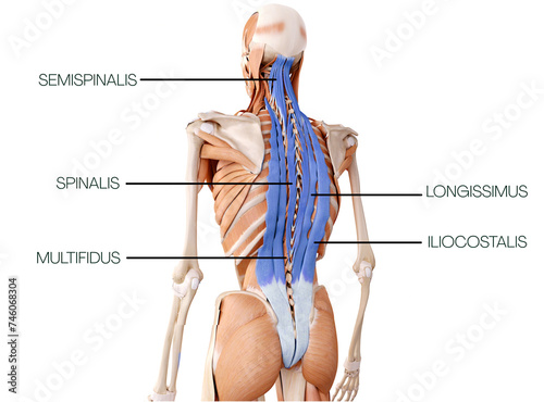 Back of superficial back line - semispinalis, spinalis, longisimus, multifidus, ilicostalis 