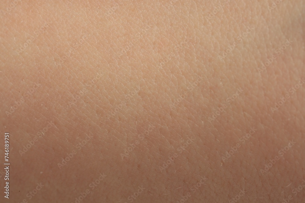 Texture of dry skin as background, macro view Texture of dry skin as background, macro view
