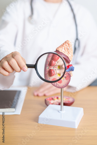 Doctor with Kidney Adrenal gland anatomy model and magnifying glass. disease of Urinary system and Stones, Cancer, world kidney day, Chronic kidney, Urology, Nephritis, Renal, Transplant and health