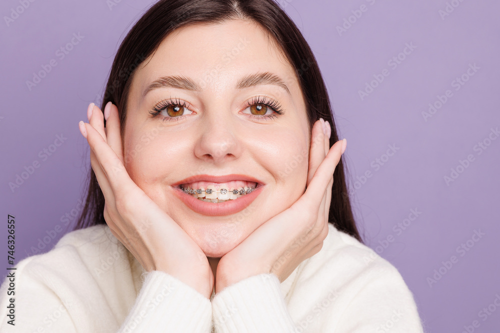portrait of a girl with braces close-up, woman is happy with braces portrait of a girl with braces close-up, woman is happy with braces