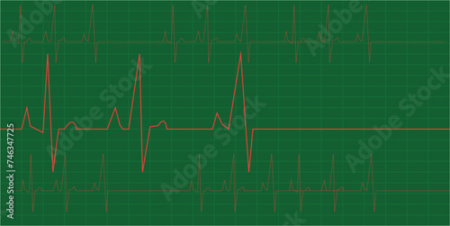 Heartbeat Make Heart