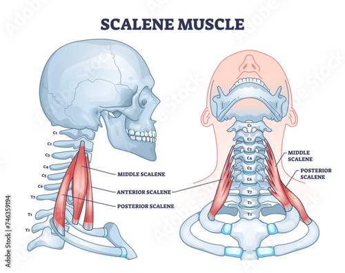 Scalene muscle structure with medical location on neck outline diagram, transparent background. Labeled educational anatomical sprain scheme with middle. photo