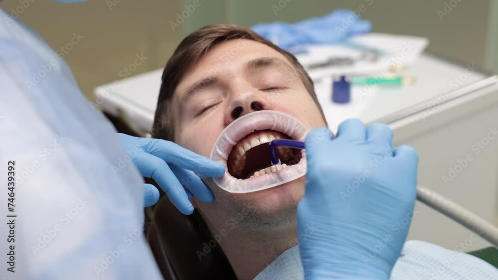 Man sit in a dental chair, saliva ejector in the mouth, caries treatment, dentist's gloved hands, dental retractor on the lips Man sit in a dental chair, saliva ejector in the mouth, caries treatment, dentist's gloved hands, dental retractor on the lips