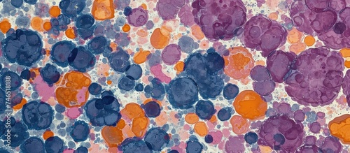 HE staining reveals liver with hepatocytes exhibiting multiple nuclei and enlarged nuclei, indicating polyploidy with multiple times the normal chromosome count. photo